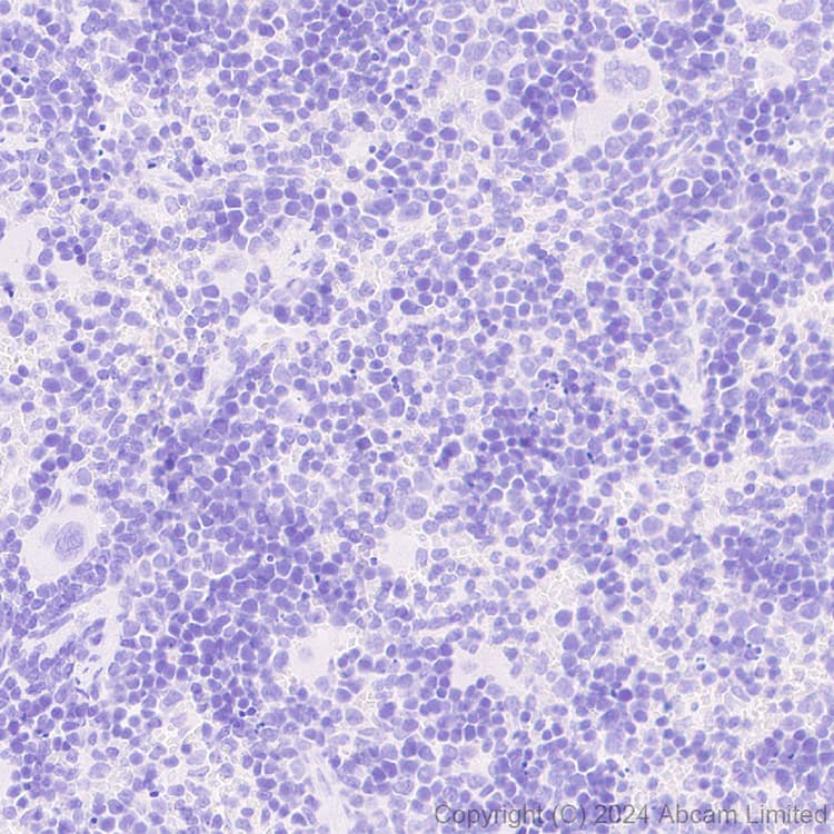 Atp6v0d2 Antibody Epr29173 521 Bsa And Azide Free Ab321810  Immunohistochemistry Formalin Pfa Fixed Paraffin Embedded Sections Img435571
