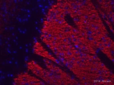 Anti-Metabotropic Glutamate Receptor 5 antibody [EPR2425Y] - BSA and Azide free(ab256589)