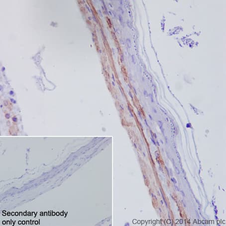 Anti-alpha smooth muscle Actin (acetyl E3) + ACTG2 (acetyl E3) antibody [E184](AB32575)