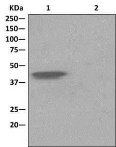 Anti-Islet 1 antibody [EPR10362](AB178400)