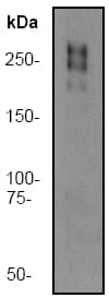 Anti-Fibronectin antibody [F14](AB45688)