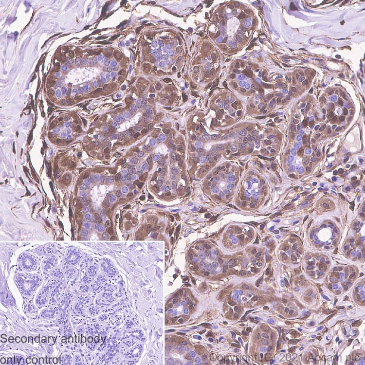 S100 Alpha 6 Pra Antibody Epr13084 69 Bsa And Azide Free Ab250543  Immunohistochemistry Formalin Pfa Fixed Paraffin Embedded Sections Img173030