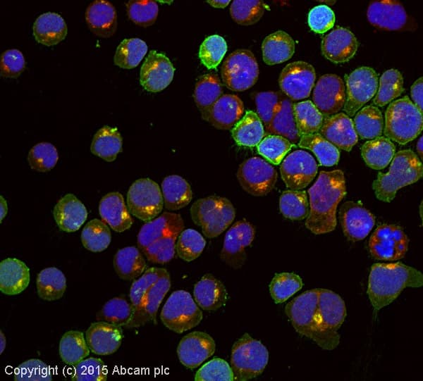 Anti-CXCR4 antibody [EPUMBR3](AB181020)