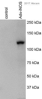 Anti-Adenovirus Type 5 antibody(ab6982)