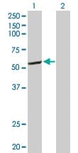 Cyp2c8 Antibody Ab103547  Western Blot Img158457