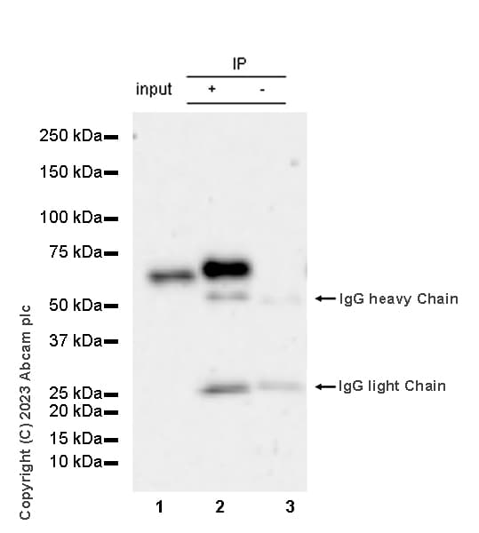 Mouse IgG1, kappa monoclonal [MOPC-21] - isotype control(AB18443)