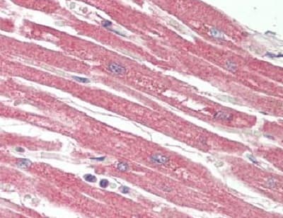 Anti-Poliovirus Receptor/PVR antibody(AB230338)