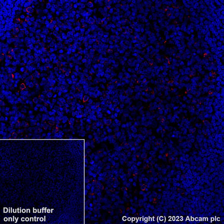 Alexa Fluor 647 Mthfd2 Antibody Epr26938 20 Ab314930  Immunohistochemistry Formalin Pfa Fixed Paraffin Embedded Sections Img422267