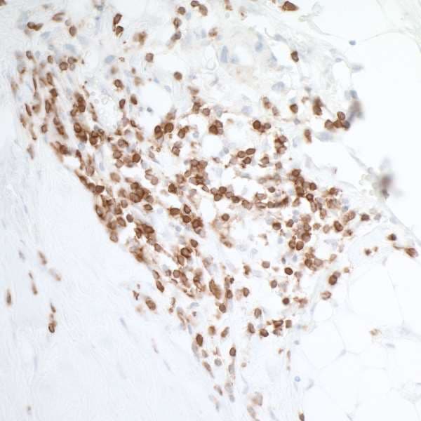 Anti-CD226 antibody [BLR063G] - BSA free(ab264415)