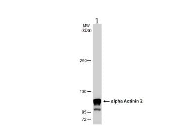 Anti-Sarcomeric Alpha Actinin antibody(AB137346)