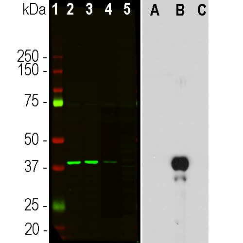 Aurora B Antibody 6g2 Ab315206  Western Blot Img423266