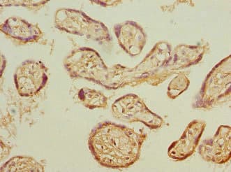 Anti-Proteasome 20S beta 3 antibody(AB230024)
