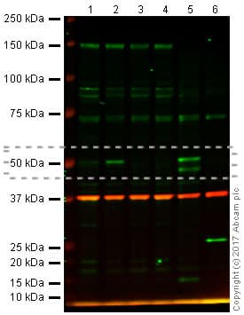 Anti-p53 antibody [PAb 240](AB26)
