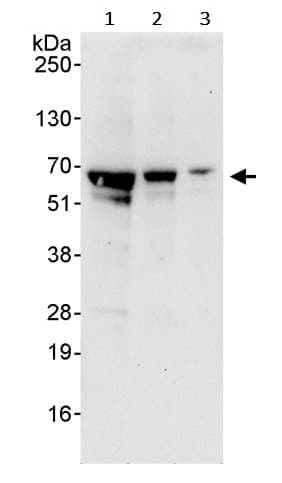 Atf2 Antibody Ab245407  Western Blot Img61812