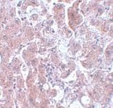 Elovl7 Antibody Ab106633  Immunohistochemistry Formalin Pfa Fixed Paraffin Embedded Sections Img113761