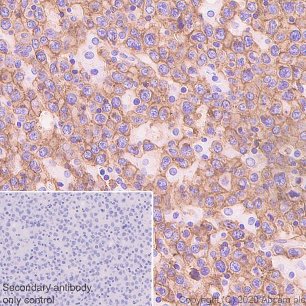 Cxcr5 Antibody Epr23463 30 Ab254415  Immunohistochemistry Formalin Pfa Fixed Paraffin Embedded Sections Img107528