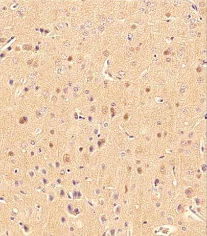 Anti-LC3B antibody - Autophagosome Marker(AB48394)