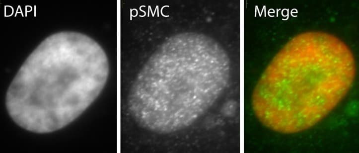 Anti-SMC1A (phospho S966) antibody(AB1276)