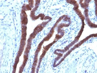Anti-EpCAM antibody [EGP40/1110](AB233919)