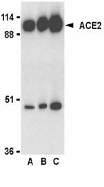 Anti-ACE2 antibody(AB15348)