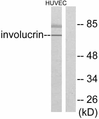 Anti-Involucrin antibody(AB53112)