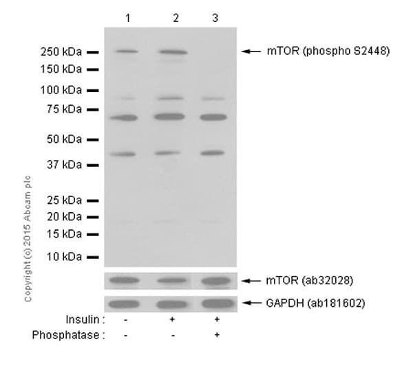 Anti-mTOR (phospho S2448) antibody [EPR426(2)](AB109268)
