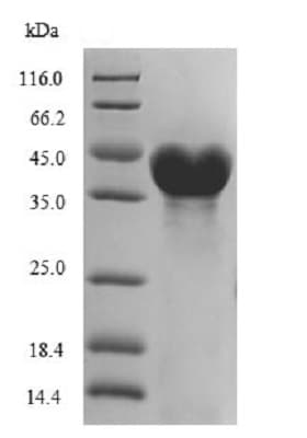 Recombinant DNA ligase protein (His tag)(AB238366)