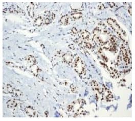 Sumo 1 Antibody Ep298 Bsa And Azide Free Ab248491  Immunohistochemistry Formalin Pfa Fixed Paraffin Embedded Sections Img133049