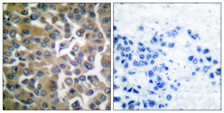 Anti-Fibroblast activation protein, alpha antibody(AB53066)