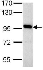Anti-ATP6V0A4 antibody(AB97440)