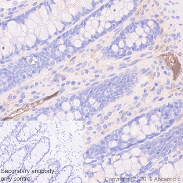 C9 Antibody Epr11232 82 Bsa And Azide Free Ab240175  Immunohistochemistry Formalin Pfa Fixed Paraffin Embedded Sections Img125434