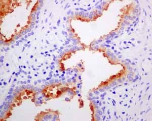 Anti-PSMA antibody [EPR6253] - BSA and Azide free(AB226141)