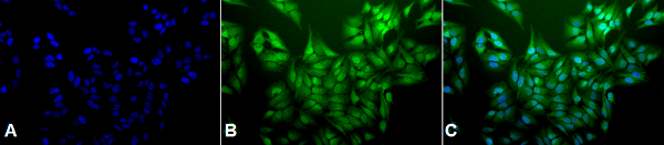 Anti-Ubiquitin antibody [5B9-B3](AB223378)