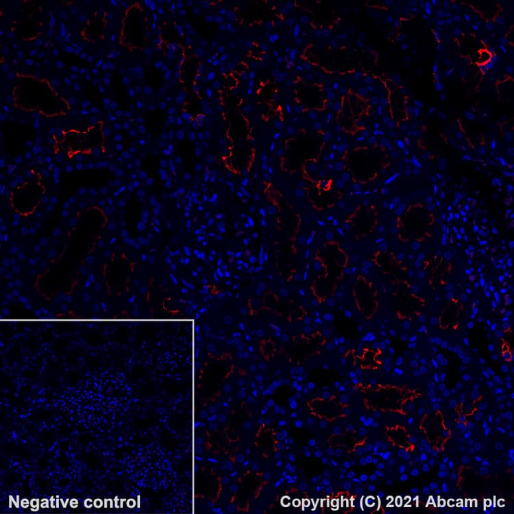 Alexa Fluor® 647 Anti-ACE2 antibody [EPR24705-45](AB283658)