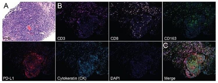 Anti-CD3 epsilon antibody [SP7] - BSA and Azide free(AB205228)