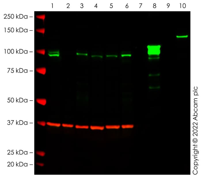 Anti-SATB1 + SATB2 antibody [SATBA4B10] - C-terminal(ab51502)