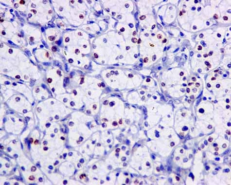 Nucleolin Phospho T76 Antibody Epr8080 2 Ab168363  Immunohistochemistry Formalin Pfa Fixed Paraffin Embedded Sections Img131190