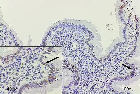 Anti-SMAD3 (pS423/425) + SMAD5 (pS463/465 ) + SMAD1 (pS463/465) + SMAD2 (pS465/467) antibody [EP823Y](AB52903)
