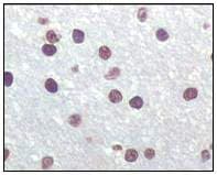 Anti-CDKN2A/p16INK4a antibody [2D9A12](AB54210)