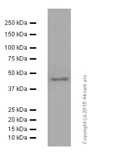 Anti-Angiotensin II Type 1 Receptor antibody [EPR3873](AB124734)
