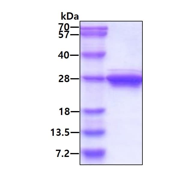 Recombinant Human Cytoglobin protein(AB97347)