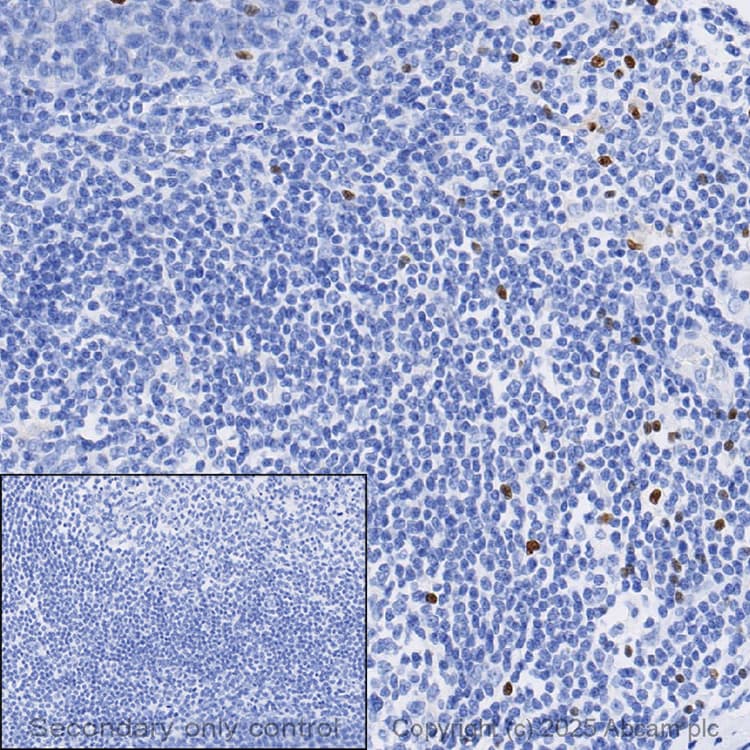 Anti-FOXP3 antibody [SP97](AB99963)