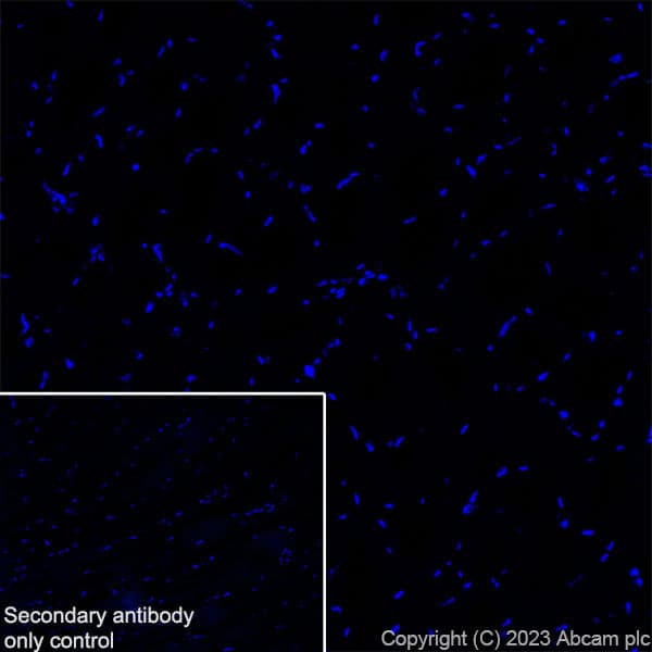 Anti-GABA A Receptor beta 2 antibody [EPR28366-42](AB309540)