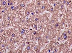 Mterf Antibody Epr14202 Ab181836  Immunohistochemistry Formalin Pfa Fixed Paraffin Embedded Sections Img133198