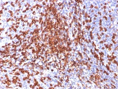 Cd44 Antibody 156 3c11 Bsa And Azide Free Ab213072  Immunohistochemistry Formalin Pfa Fixed Paraffin Embedded Sections Img23084