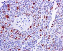 Nucleolin Phospho T76 Antibody Epr8080 2 Ab168363  Immunohistochemistry Formalin Pfa Fixed Paraffin Embedded Sections Img137778