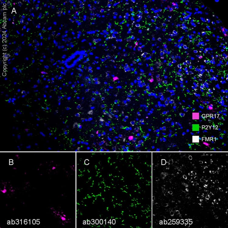 Anti-FMRP antibody [EPR23852-90] - BSA and Azide free(AB277489)