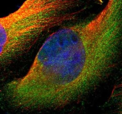Sv2a Antibody Ab224073  Immunocytochemistry Immunofluorescence Img122318