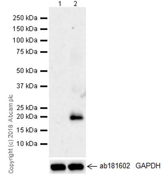 Anti-IL-6 antibody [EPR21711](AB233706)