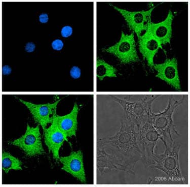 Anti-Firefly Luciferase antibody(AB21176)